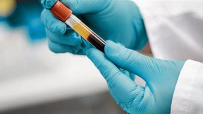 علماء يكشفون عن علاج مناعي جديد لأحد أنواع سرطان الدم 