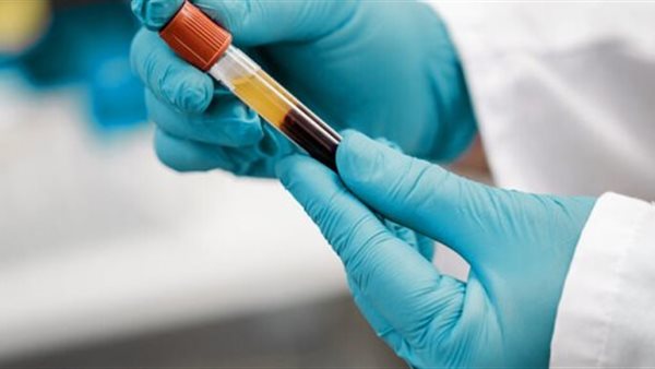 اكتشاف سرطان الدم