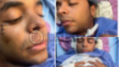 طعنتان بالرقبة.. التقرير الطبي لصاحب محل الملابس المعتدى عليه في المطرية | مستند