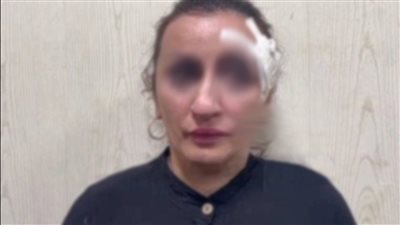 روسية تبيع طفلها بـ 3200 دولار لإجراء جراحة تجميلية بأنفها