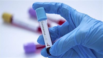 أمريكا تعلق اختبارات فيروس كورونا المجانية