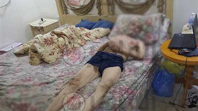 بسبب الغرغرينا.. قصة طبيب مصري سافر إلى السعودية منذ 15 عاما انتهى به الحال في شوارع جدة