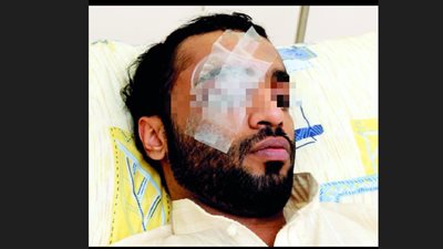  فقأ عينه.. حبس سائق التوك توك المتهم بالتعدي علي شاب بالمطواة في الزيتون