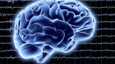 دراسة جديدة تكشف علاجًا لمرض الزهايمر عن طريق الموجات فوق الصوتية