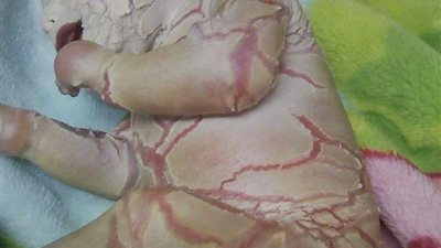 تعاني من مرض نادر.. مواطن يستغيث بوزارة الصحة لنقل ابنته لمستشفى أبو الريش (صورة)