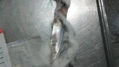 فريق طبي بمستشفى قنا العام ينجح في إخراج سكين من ظهر شاب (صورة)