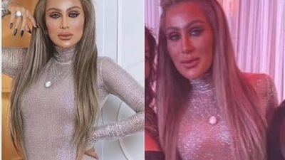 هل يعود وجه مايا دياب لطبيعته بعد “البوتكس”؟.. طبيب تجميل يجيب (صور)