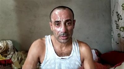 بعد تعرضه للحرق في انفجار أسطوانة بوتاجاز.. مأساة مواطن من الشرقية يحلم بـ تكافل وكرامة | فيديو