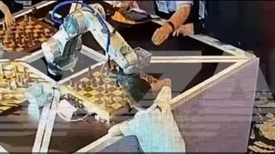 بعد كسر روبوت إصبع طفل خلال منافسة شطرنج بـ موسكو.. الكومي: الإنسان الآلي مُدرّب على رد الفعل السريع