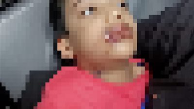 بيأكل ضوافره ويهرش في رِجله.. زوجة ووالدتها تتهربان من اتهامهما بتعذيبهما ابن الزوج بالقليوبية | خاص