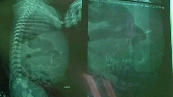 حالة المولدة 