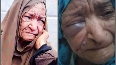 ضربتها في عينها.. مشرفة تعتدى على مسنة سبعينيَّة بـ دار بسمة للإيواء.. وأخصائية: ليست المرة الأولى