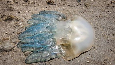 الخل والمياه الساخنة.. طبيب جلدية يوضح الإسعافات الأولية للوقاية من لسعة قنديل البحر