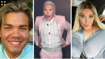 90 عملية جراحية.. بريطاني يتحول جنسيًا ليشبه دمية باربي | صور