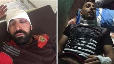 إصابة شخصين في حادث انقلاب دراجة نارية بالغربية 