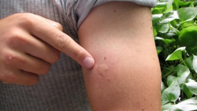  دراسة: المخاطر المناخية تسببت في تفاقم الأمراض المعدية 