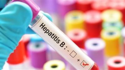 الصحة الأمريكية: البالغون المصابون بالتهاب الكبد سيحصلون على العلاج بغض النظر عن العِرق