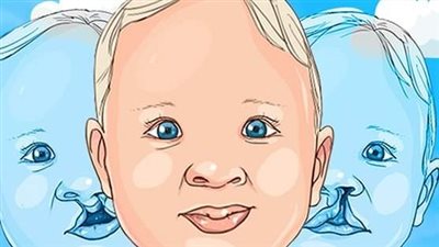 عدم التحام أنسجة الشفة العليا.. متى يصاب الطفل بالشفة الأرنبية؟ 