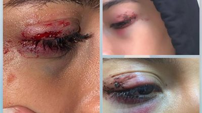 حجز عامل الكافيه المتهم بالتحرش والتعدي على فتاة المعادي 24 ساعة