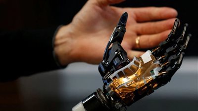 ذراع إلكترونية قابلة للتحديث من أي مكان بالعالم.. شركة بريطانية تُطور طرفا صناعية لسباحة أسترالية