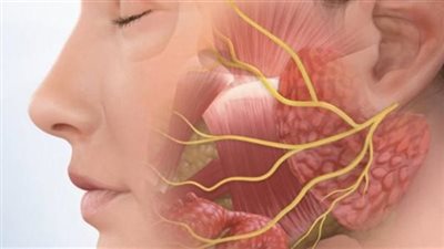 أعراض الإصابة بالعصب السابع.. تعرف عليها