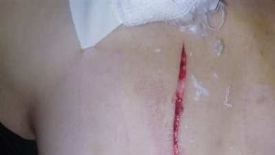 14 طعنة.. تفاصيل استدراج مسجلين سائق توك توك وسرقته بعد الاعتداء عليه بطنطا