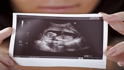 أمريكا تطور اختبار جديد للحوامل يكشف الإضرابات الوراثية قبل ولادة الجنين