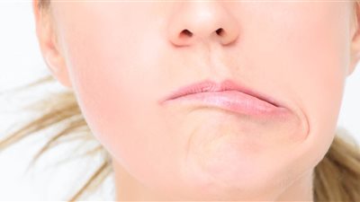 أعراض الإصابة بالعصب السابع.. تعرف عليها