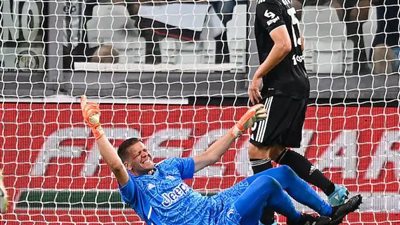 رسميًا.. يوفنتوس يعلن تفاصيل إصابة تشيزني