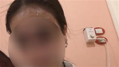 القصة كاملة لتعرض فتاة للعنف الأسري في الدقهلية.. ووالدها: كنت بأدِّب بنتي وتَعَدَّت عليّ وعلى والدتها