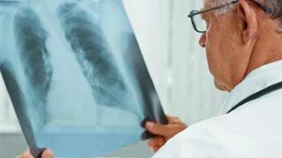 تسبب في وفاة 3 أشخاص.. ظهور مرض غامض بالأرجنتين ومخاوف من تفشي فيروس جديد