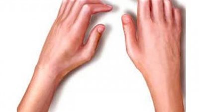 في يومه العالمي.. طرق وقائية من الإصابة بالروماتيزم 