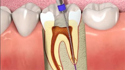 الرعاية الصحية تستعرض الخدمات المقدمة في عيادات الأسنان تحت مظلة التأمين الصحي الشامل