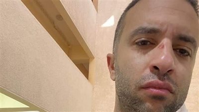 إصابة محمد سراج عضو مجلس إدارة الأهلي في حادث سير