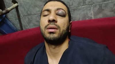 مرافقو مريض يتعدون بالضرب على فني أشعة بمستشفى المنشاوي العام بطنطا │صور
