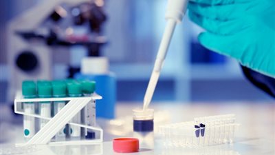 الإدارية العليا: لا يجوز لطبيب الصيدلة مزاولة مهنة التحاليل الطبية 