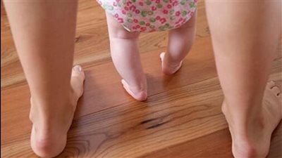 مش هتتعدل من تلقاء نفسها.. مستشفى النصر ببورسعيد تُعلن عن توافر علاج تقوس الساقين