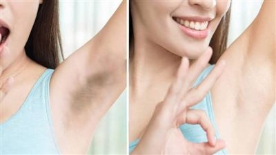 وصفات تفتيح المناطق الحساسة.. البطاطا الخيار حل سحري