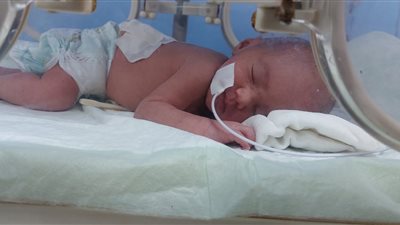 عمودها الفقري لن يكتمل.. أب يستغيث لعلاج طفلته: لو معملتش العملية هتعيش مشلولة  