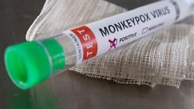 لقاح جدري القرود يؤدي إلى استجابة مناعية قوية | دراسة