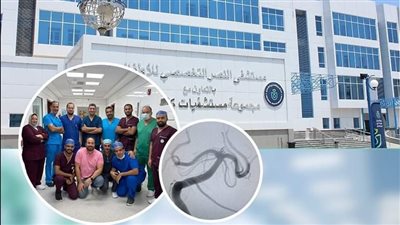 نجاح جراحة قسطرة مخية خطيرة بالتأمين الصحي الشامل ببورسعيد
