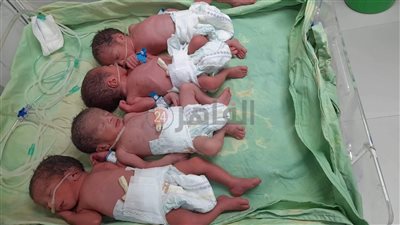بعد حرمان 5 سنوات.. سيدة تضع 4 أطفال توائم بأسيوط | صور