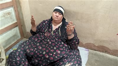 استجابة لـ القاهرة 24.. مجلس الوزراء يوجه مستشفيات جامعة المنوفية بعلاج مريضة السمنة المفرطة