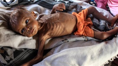 تقارير دولية: شخص واحد يموت من الجوع كل 4 ثوان في العالم