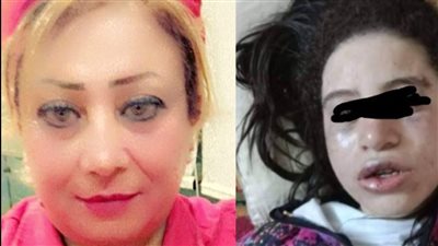 مسئولة حماية الطفل ببورسعيد تتلقى تهديدًا من أب تعدى على ابنته: وقفت ضده وقالي هحرق عربيتك