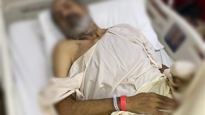 يحتاج لجراحة بالمخ.. تفاصيل علاج مصري بالسعودية سقط في الشارع فجأة