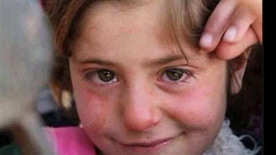 قلق في الليل وتوتر بالنهار.. تقرير فرنسي يسلط الضوء على معاناة أطفال فلسطين تحت الاحتلال الإسرائيلي