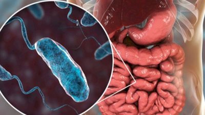 الهند تفرض إجراءات احترازية بعد تفشي الكوليرا