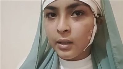 طالبة تعتدي على زميلتها بالبحيرة وتصيبها بـ 25 غرزة.. والضحية: قالتلي هروحك على نقالة | بث مباشر