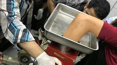 بتر إصبعي عامل محل جزارة بـ مفرمة في بورسعيد 